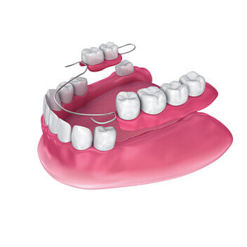 Dentures Brentwood, Essex - Smile HQ