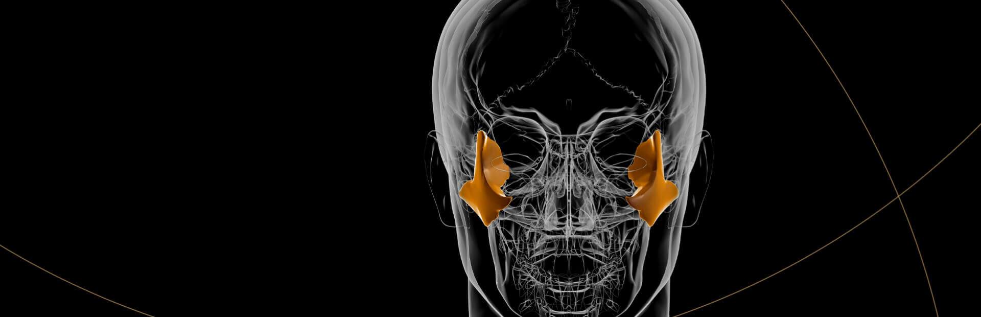 Zygomatic Implants Brentwood, Essex - Smile HQ