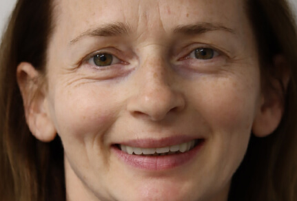 A woman with medium-length brown hair and a bright, natural smile, showing her teeth.