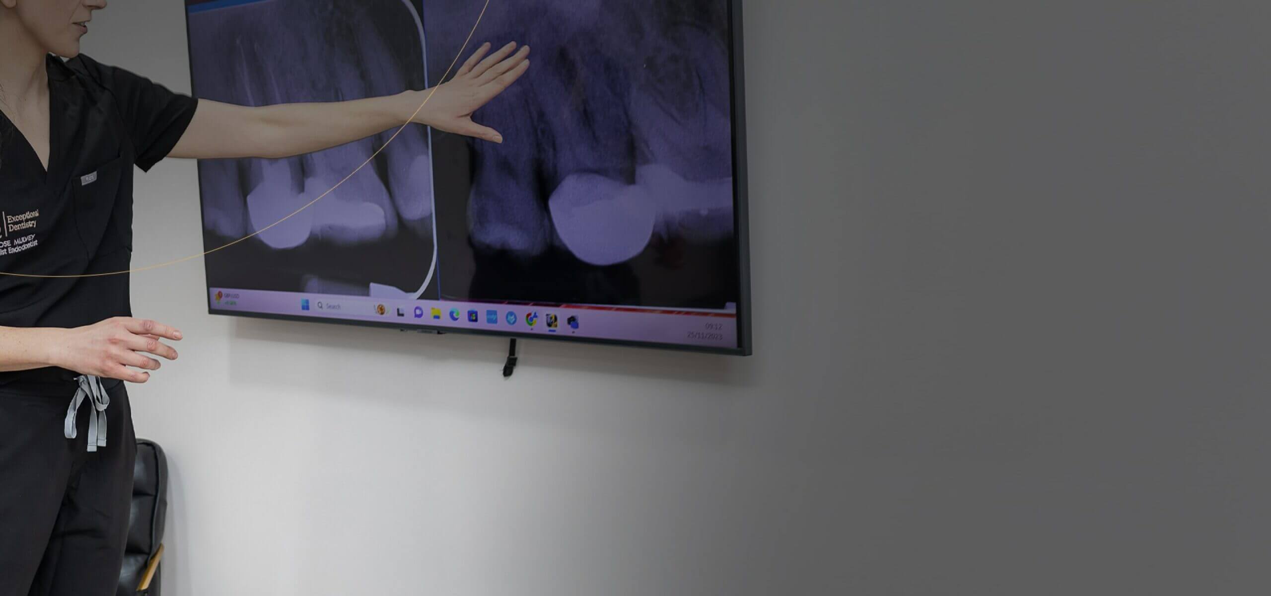 Root Canal Brentwood, Essex - Smile HQ
