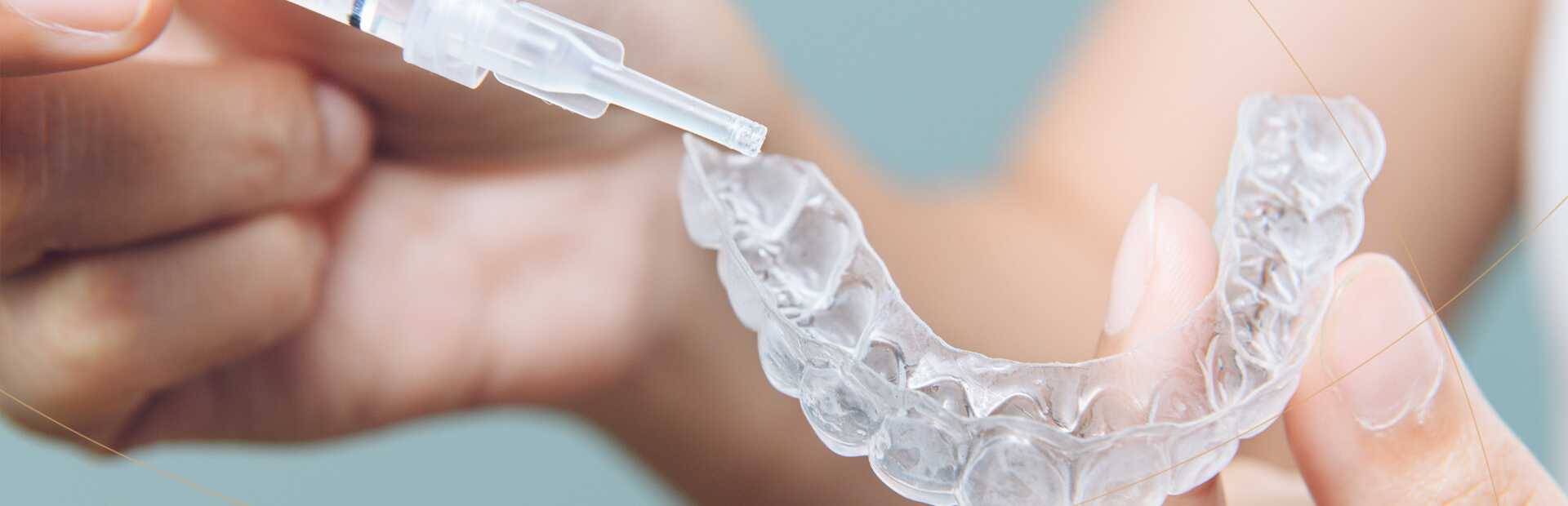 Teeth Whitening Brentwood, Essex - Smile HQ