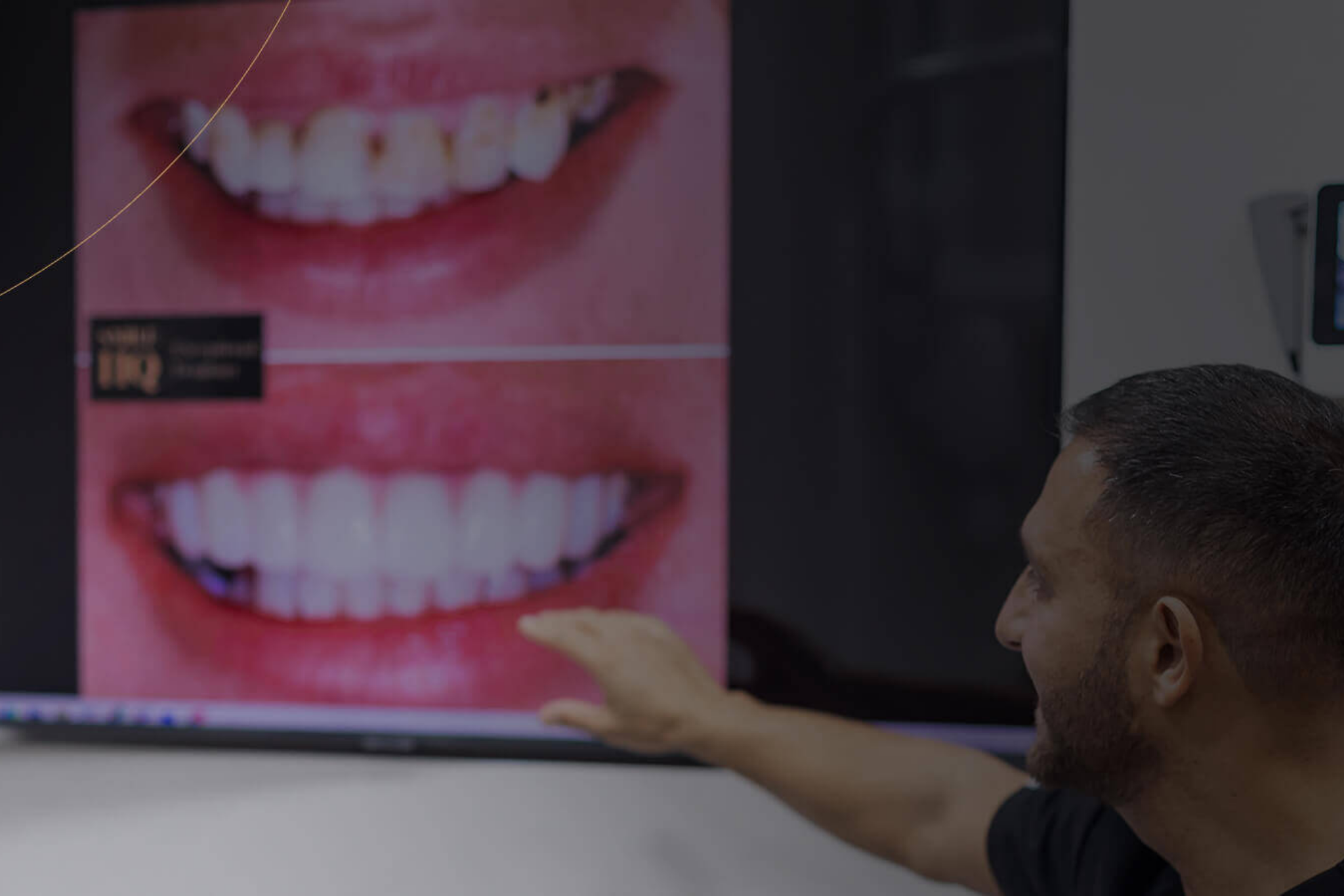 Cosmetic dentist Dr Pola Reza in Brentwood Essex showing smile makeover before and after results for patients from Harlow and Southend-on-Sea